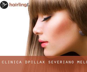 Clinica D'pillax (Severiano Melo)